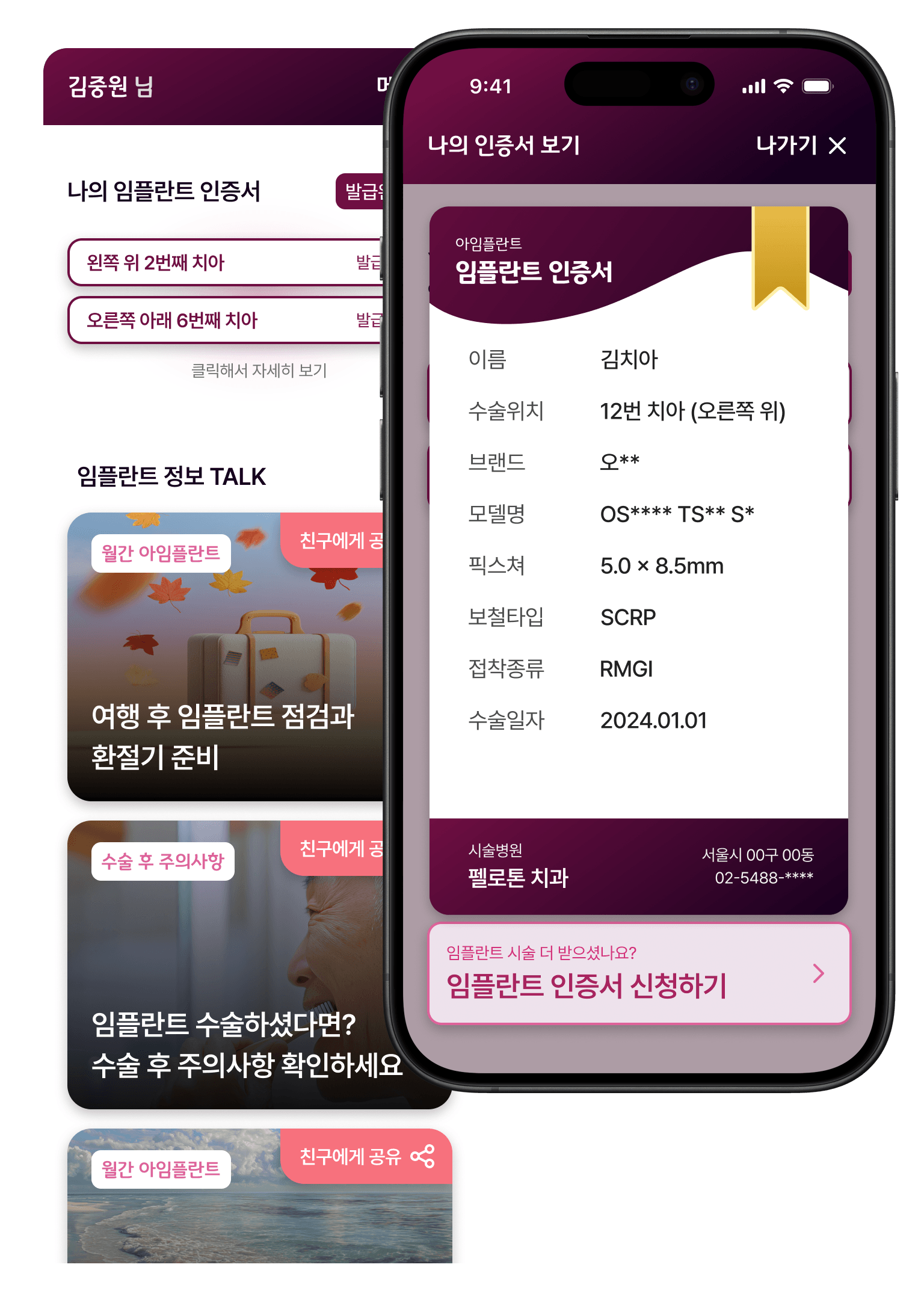 임플란트 주요 기능